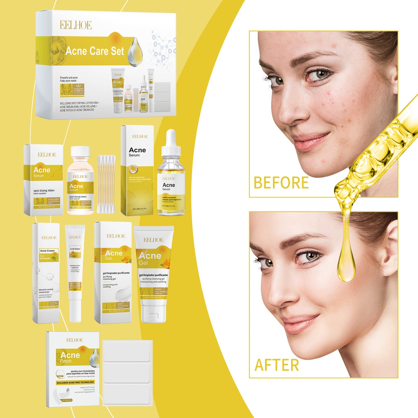 GlowScar™ Active Acne Skin Care Set