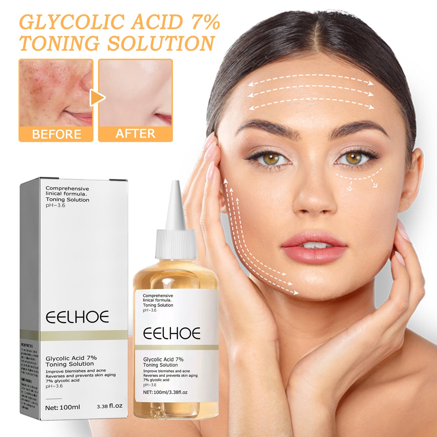 GlowMist™ Acne Repair Toner – Glycolic Acid 7%